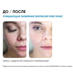 Эмульсия энзимная для умывания / Re: Program Cleansing Emulsion Pure Sonic 150 мл