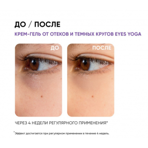 Крем-гель от отеков Йога для глаз / Smart Eyes Yoga Anti Puff Cream Gel 15 мл