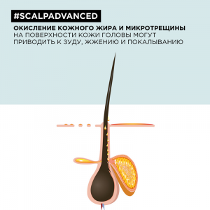 Шампунь регулирующий баланс чувствительной кожи головы / SCALP ADVANCED 300 мл