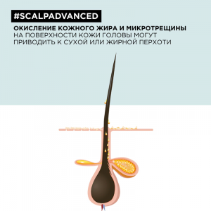 Шампунь от перхоти / SCALP ADVANCED 300 мл